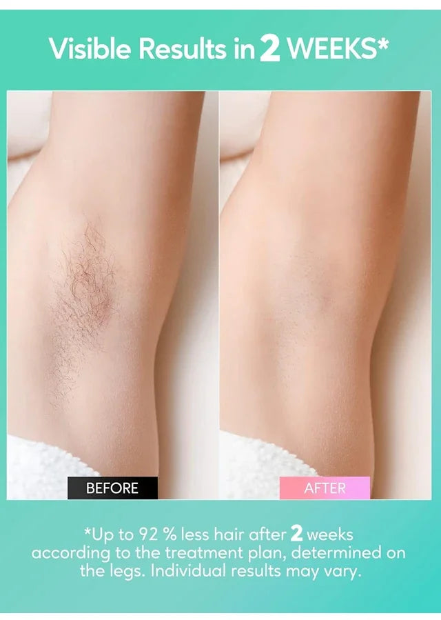 SilkGlow IPL