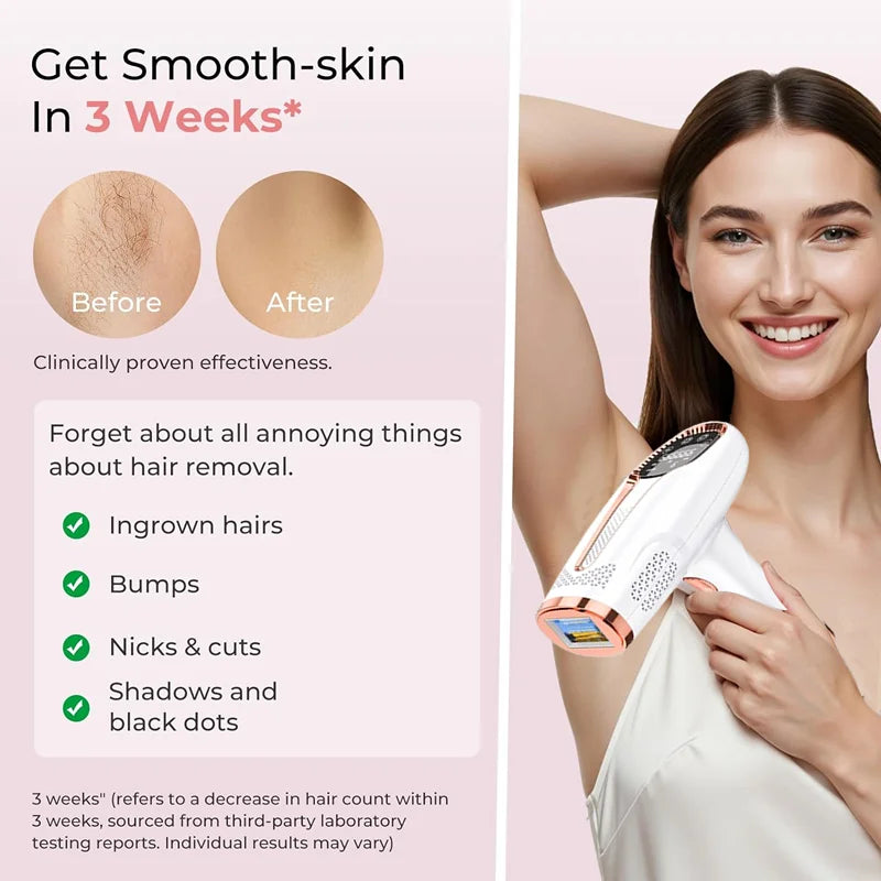 SilkGlow IPL